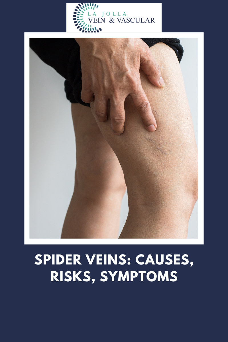 16 spider veins
