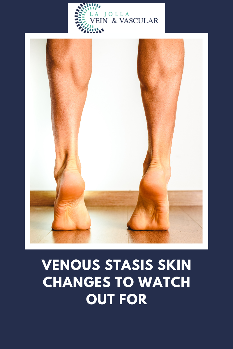 venous