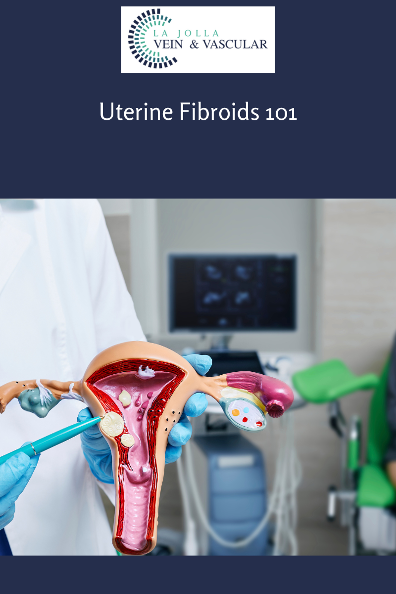 uterine fibroids