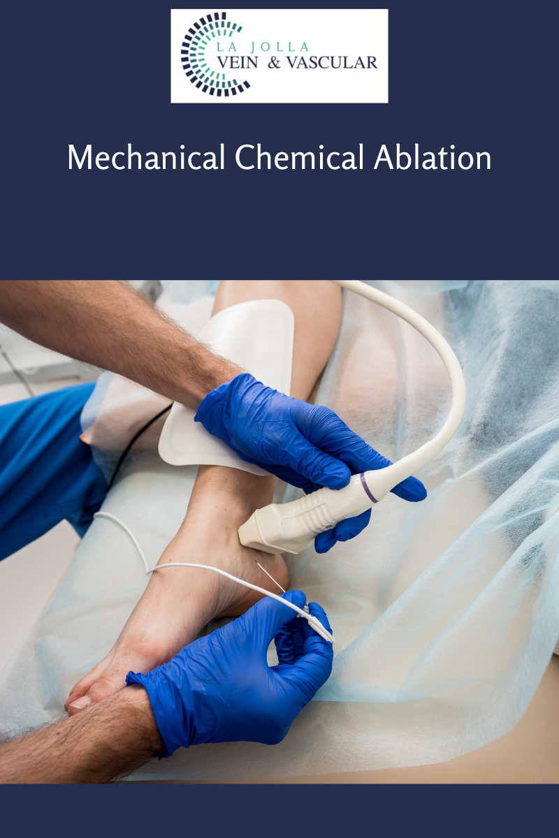 mechanical chemical ablation