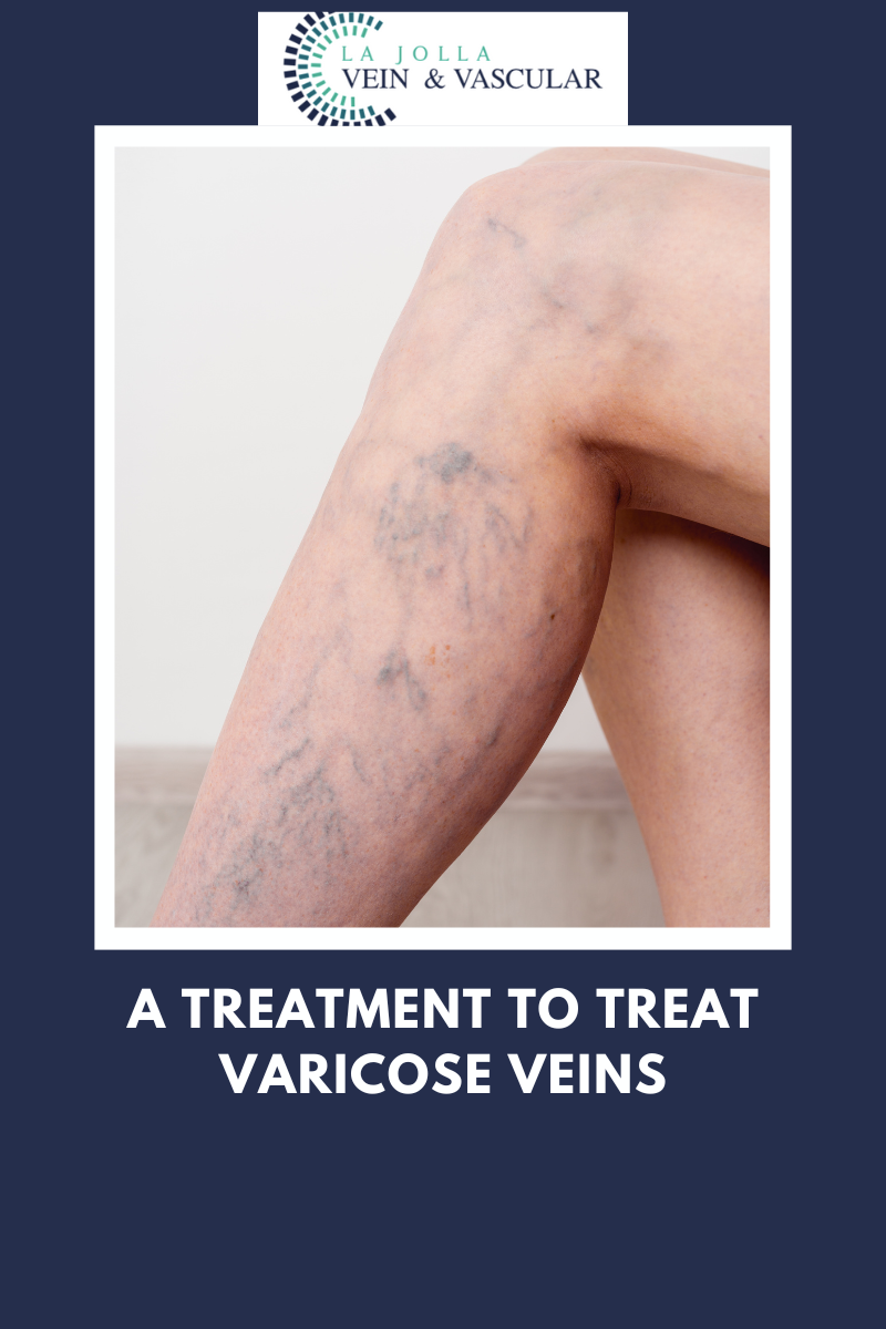treatment