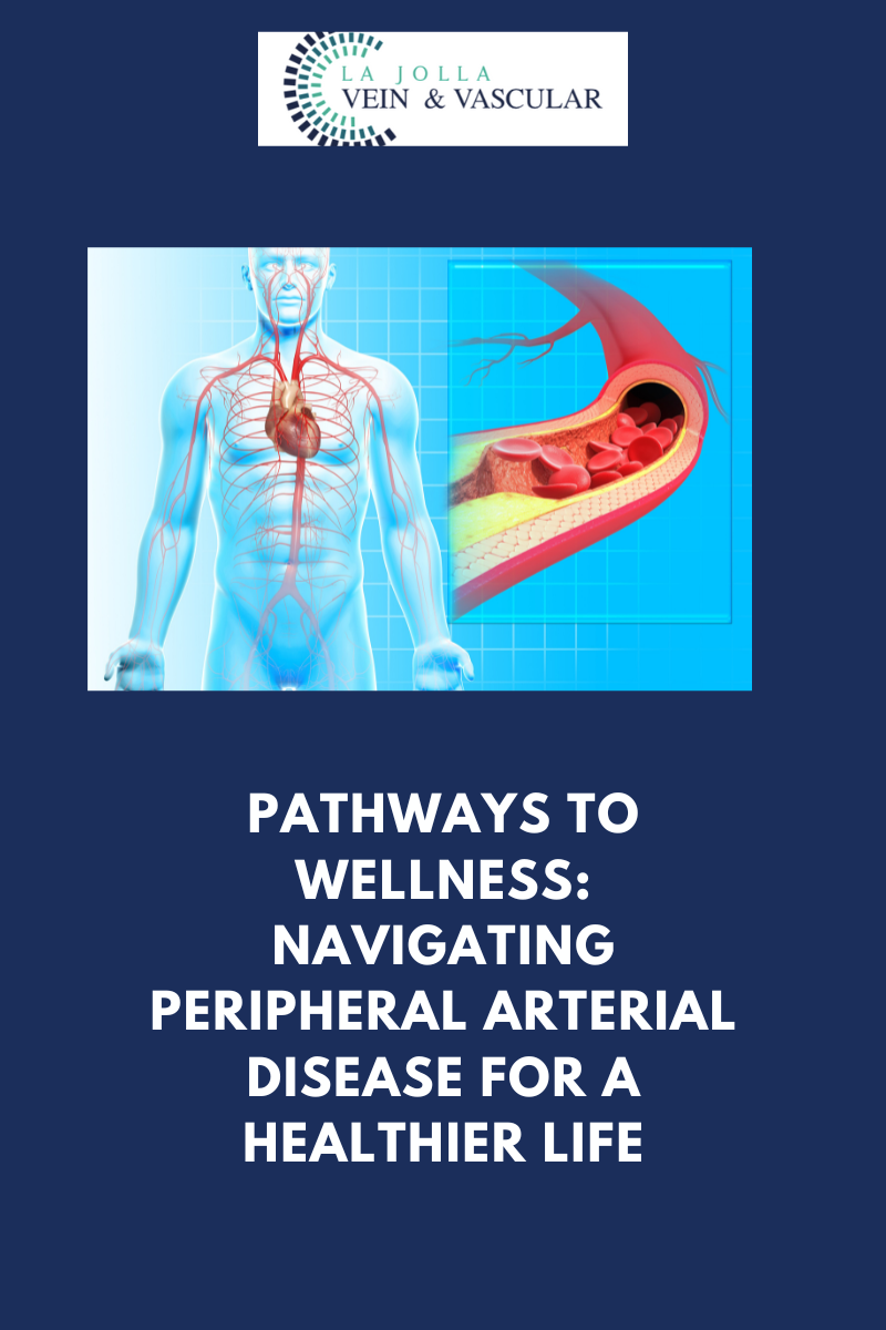 peripheral