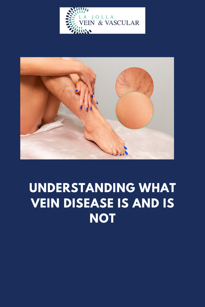 vein disease