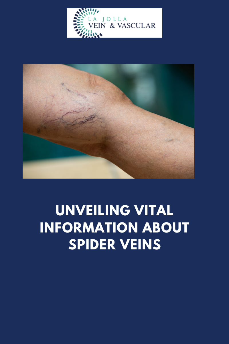 spider veins
