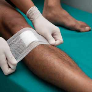 Healing Leg Ulcers: Effective Venous Disease Management