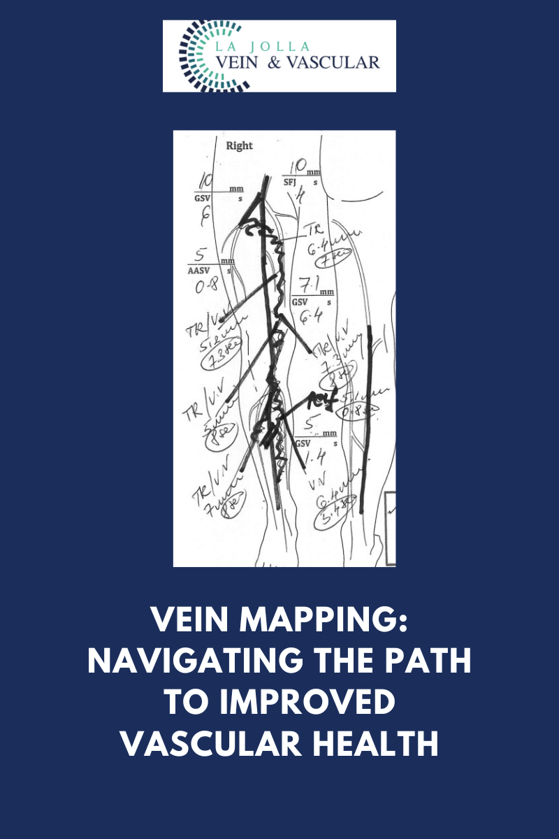 dec15 vein mapping