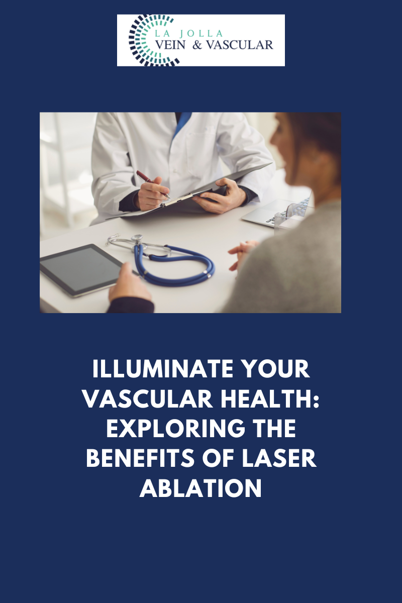 nov22 Benefits of Laser Ablation - La Jolla Vein & Vascular