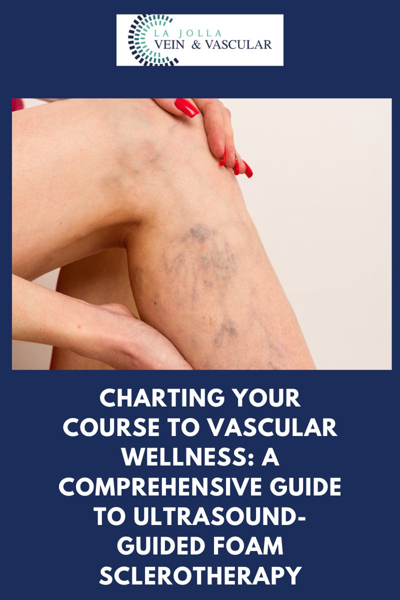 nov27 Comprehensive Guide to Ultrasound-Guided Foam Sclerotherapy