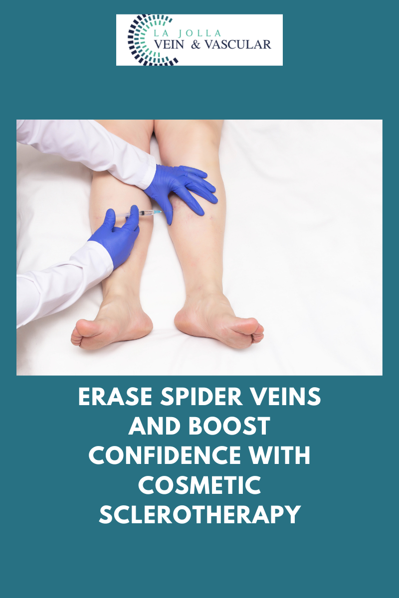nov30 sclerotherapy