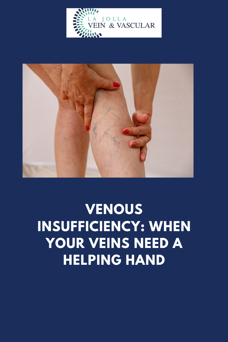 Venous Insufficiency Treatment | Vein & Vascular Care