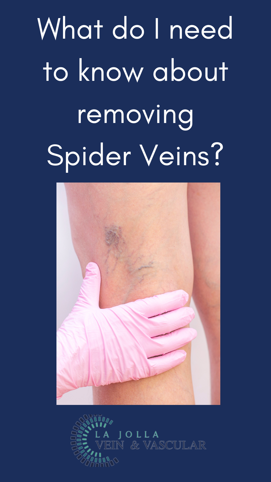 Bunke March Blog Thumbnail-33 What Do I Need to Know About Removing Spider Veins?