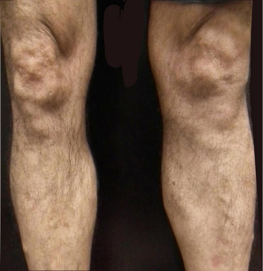 Before and After Gallery 1 After1.jpg