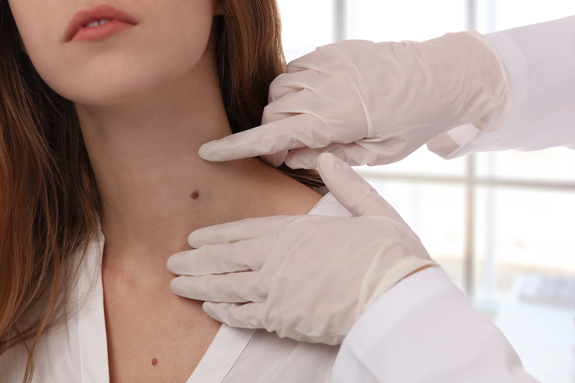 Dermatologist checking a mole on female patient's neck