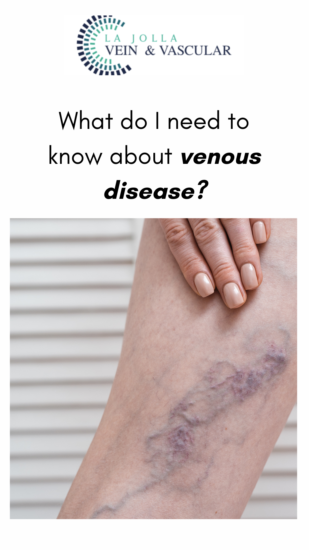What Do I Need to Know About Venous Disease? [2024]
