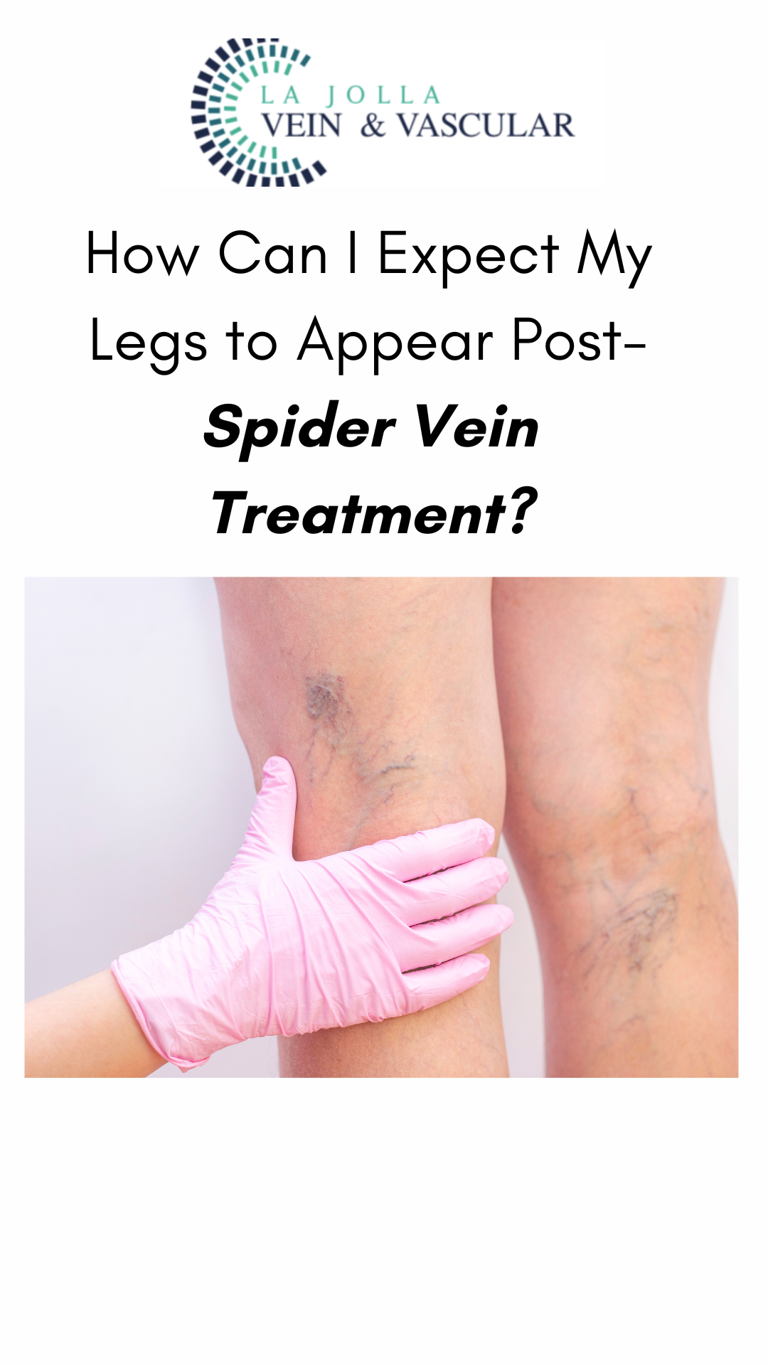 spider vein