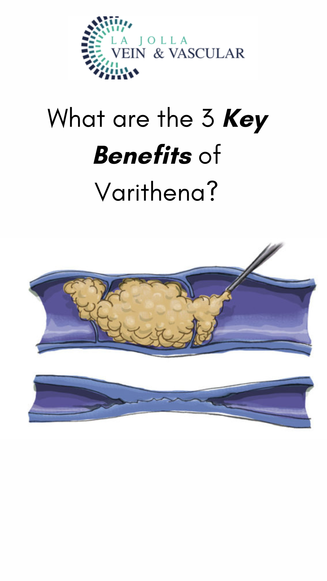 varithena