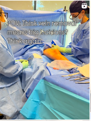 POV no bif incisions